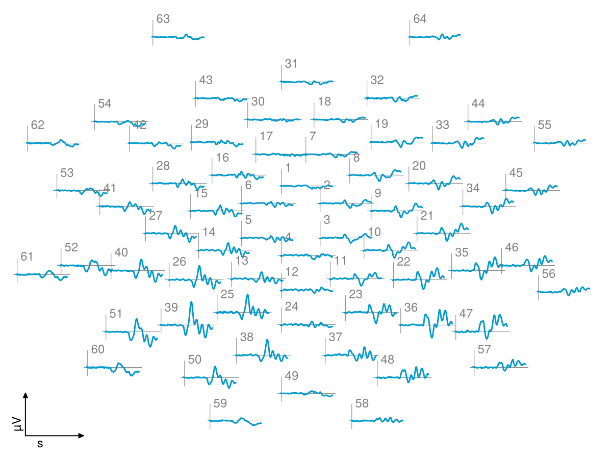 Example block output