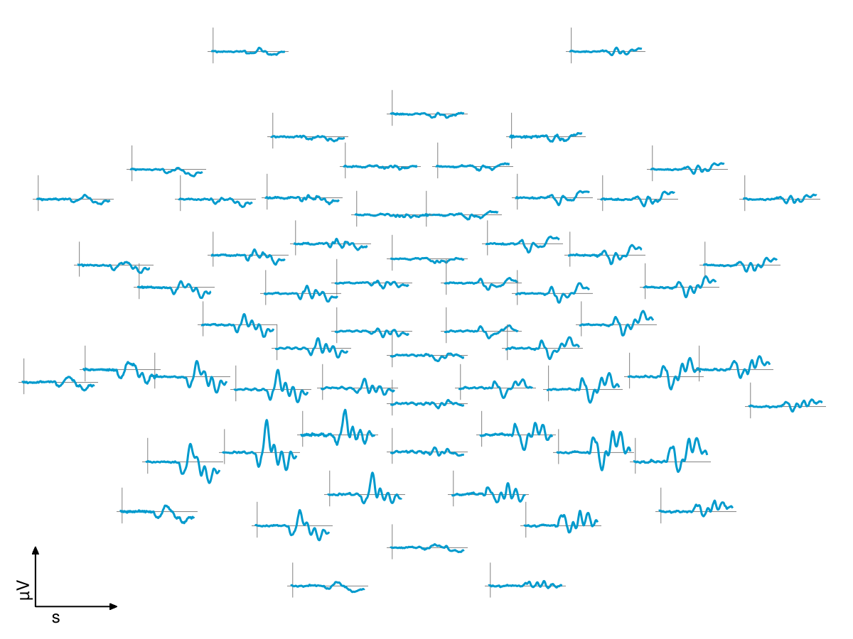 Example block output