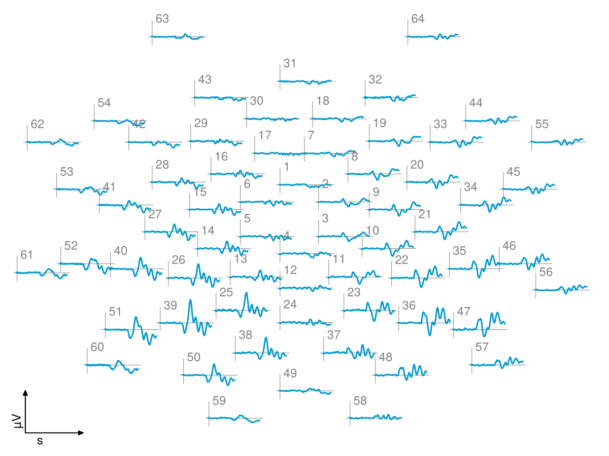 Example block output