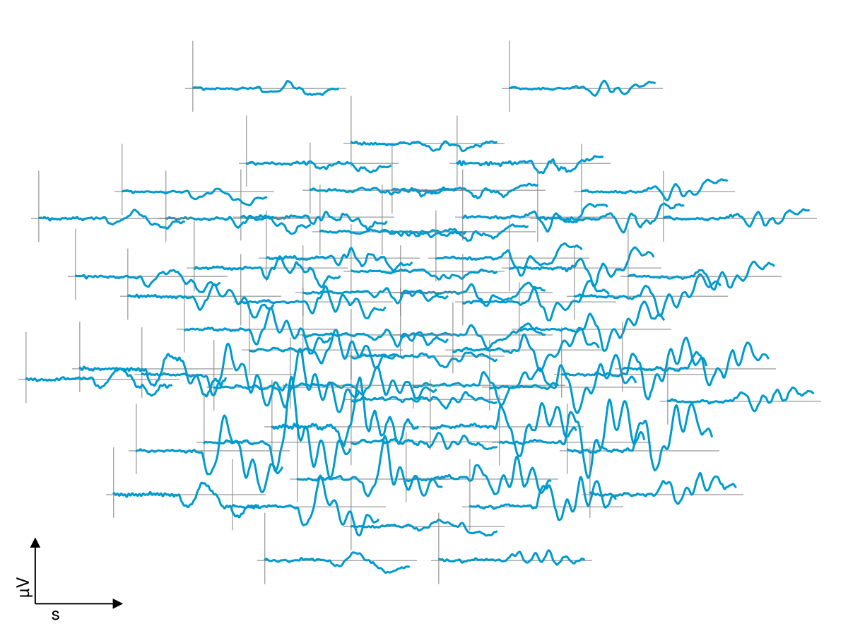 Example block output