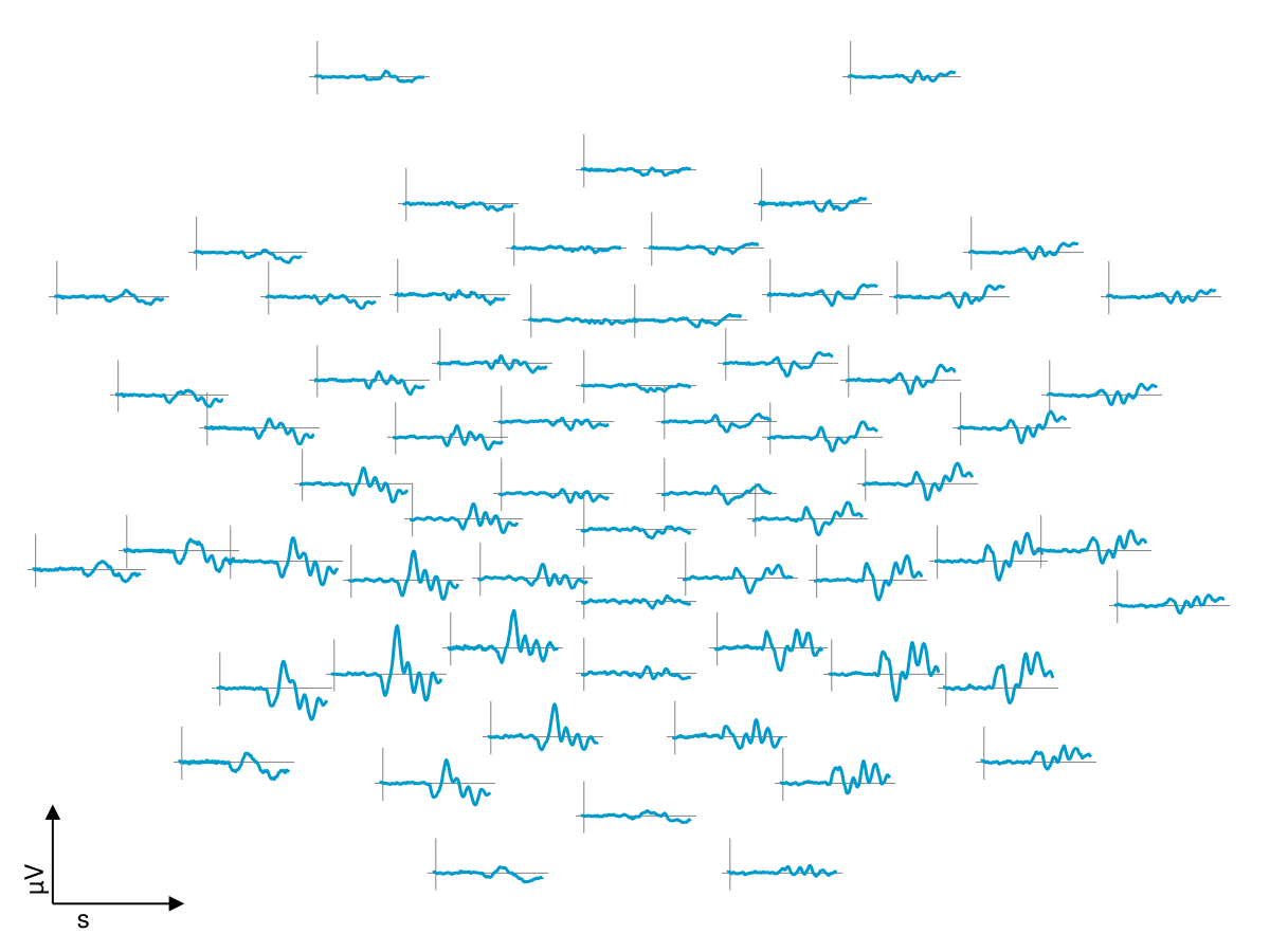 Example block output